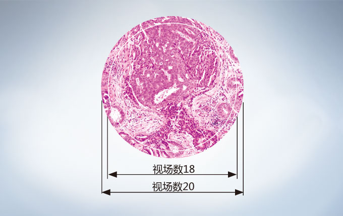 OLYMPUS奧林巴斯 CX23生物顯微鏡 【三目|雙目|熒光|相差】-普赫光電