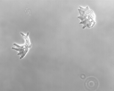 Amoeba_Proteus_Phase_Contrast_2_03_1c24d8d78b